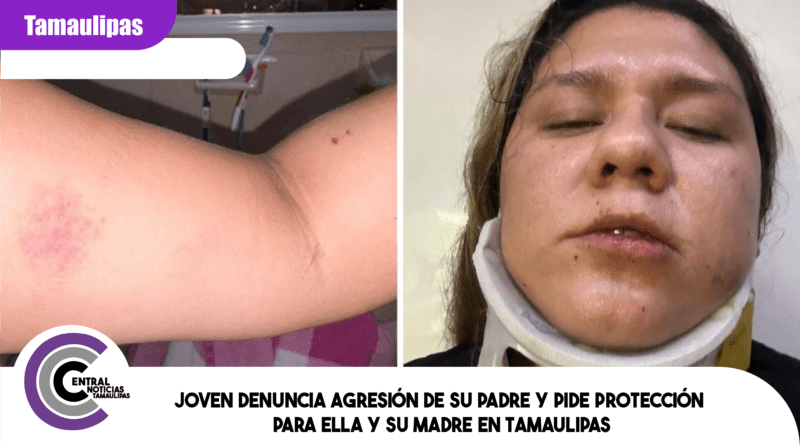 Joven denuncia agresión de su padre y pide protección para ella y su madre en Tamaulipas